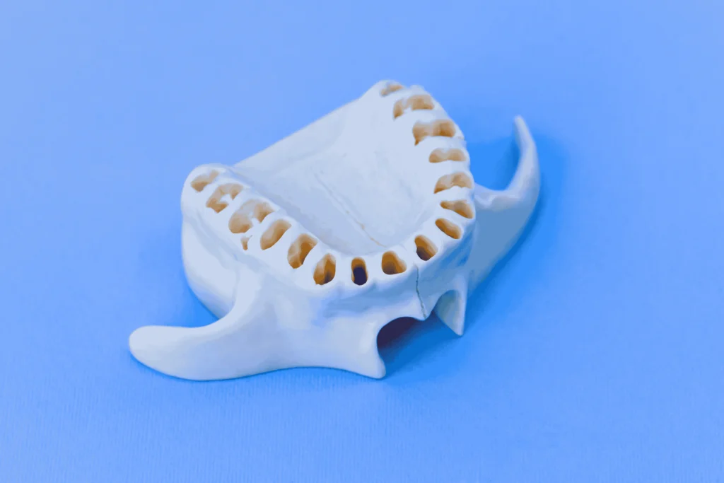 denti-mancanti-come-sostituirli