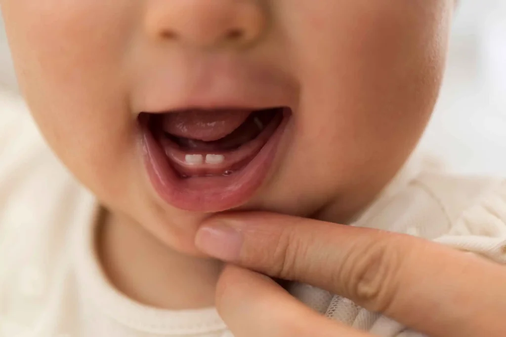 dolore-dentizione-bambini